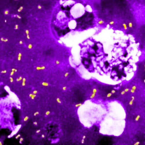 O bacterie microscopică a influențat de trei ori istoria omenirii, provocând pandemii mortale și victime înzecite, relatează digi24.ro. Potrivit cercetătorilor, un "truc genetic" surprinzător explică modul în care microbul care provoacă ciuma, yersinia pestis, a reușit să supraviețuiască timp de sute de ani. Astfel, bacteria și-a redus gradul de virulență în mod paradoxal, pentru a putea infecta mai mult, dar pe o perioadă mai lungă, notează El Pais.