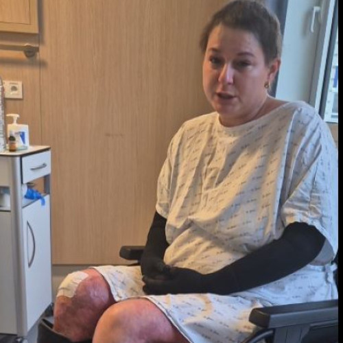 Lavinia Vlad va fi externată după tratamentul în Belgia pentru arsuri extinse